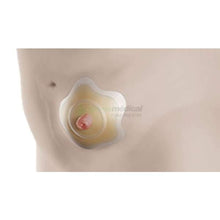 Charger l'image dans la galerie, Collerette Sensura Mio Click - Concave - À découper Collerette concave Coloplast