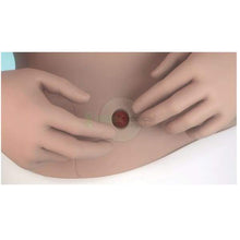 Load image into Gallery viewer, Anneau Moulable Brava 2.0Mm Anneaux Coloplast
